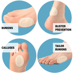 bunions, blister prevention, calluses, tailor bunions